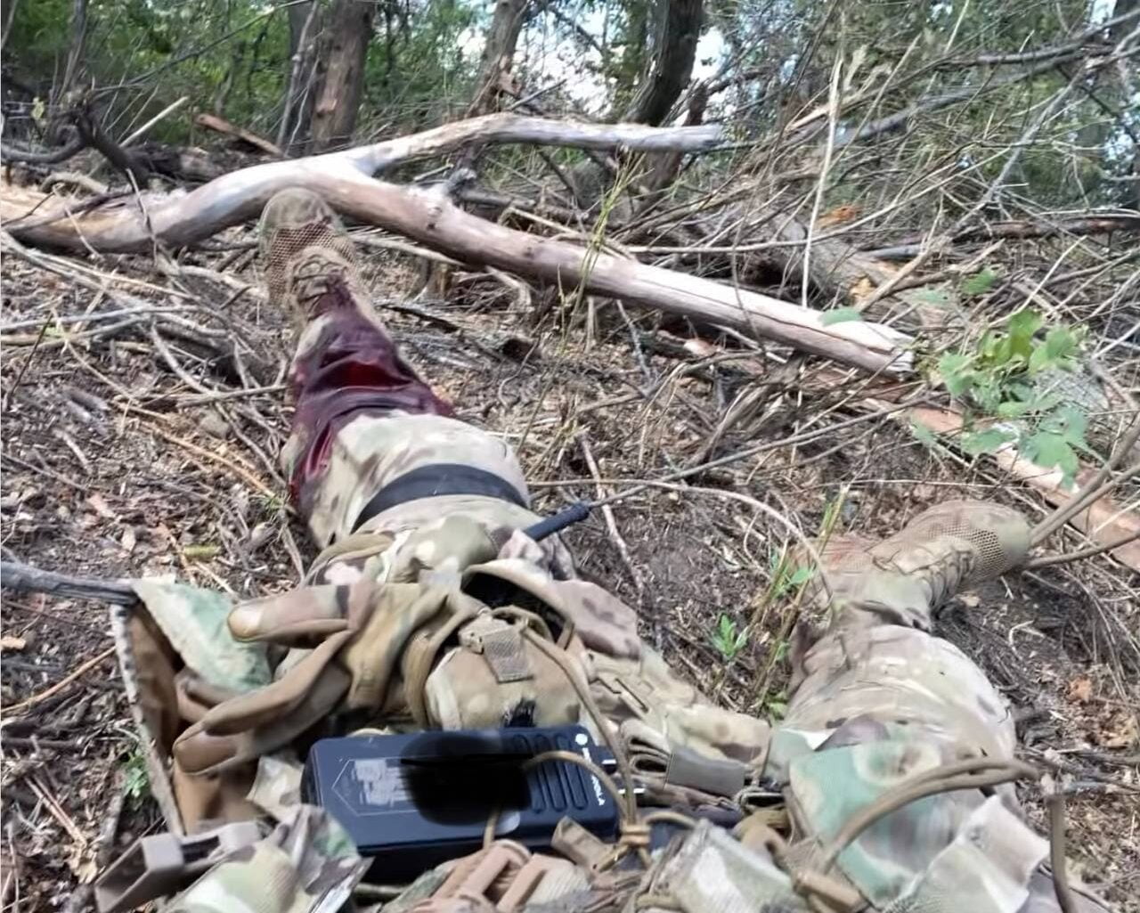 1 Рівненський військовий розповів історію запеклого бою, де отримав поранення