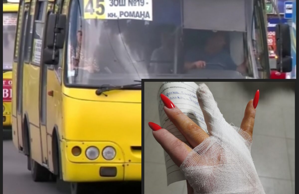 Рівнянці відірвало шматок пальця у маршрутці, поліція встановлює обставини (ФОТО)