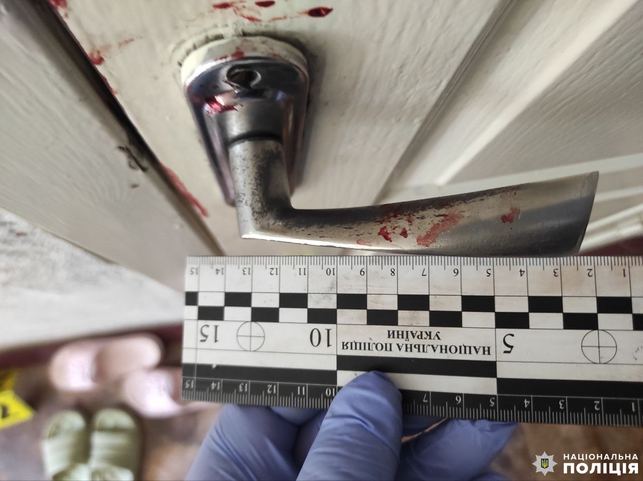 1 На Рівненщині затримали чоловіка, який завдав численні ушкодження колишній дружині