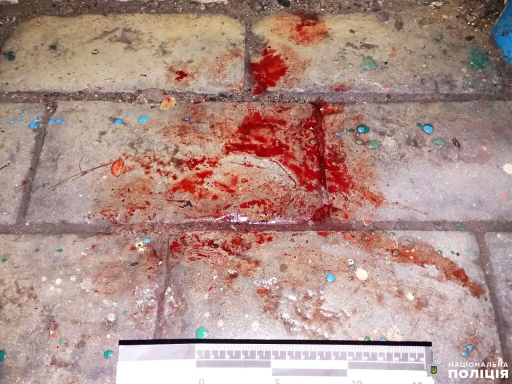1 Рівнянку викрали і жорстоко побили, а потім викинули на зупинці (ФОТО)