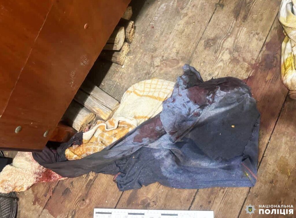 1 На Рівненщині посварилися сусіди: одного з них з численними ножовими пораненнями доставили у лікарню