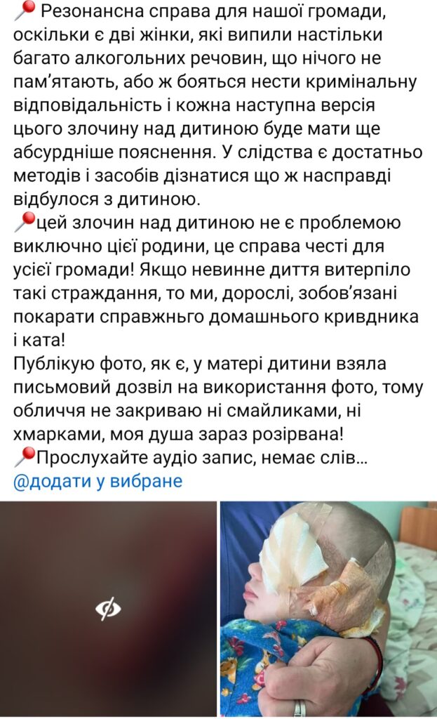 1 Розпочато досудове розслідування щодо отримання тілесних ушкоджень 2х річною дитиною