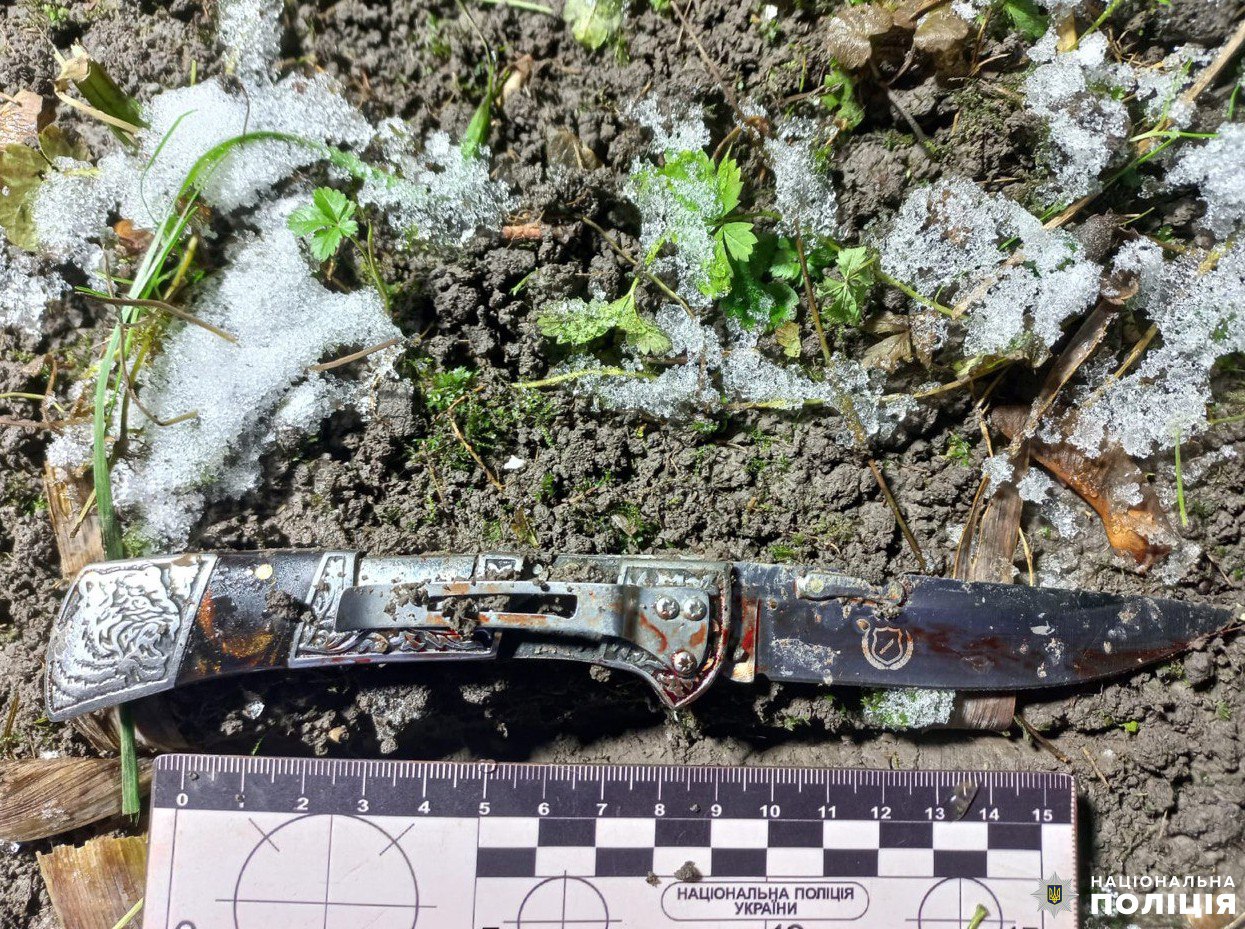 Жителю Рівного загрожує до 15 років ув’язнення через замах на умисне вбивство 0000
