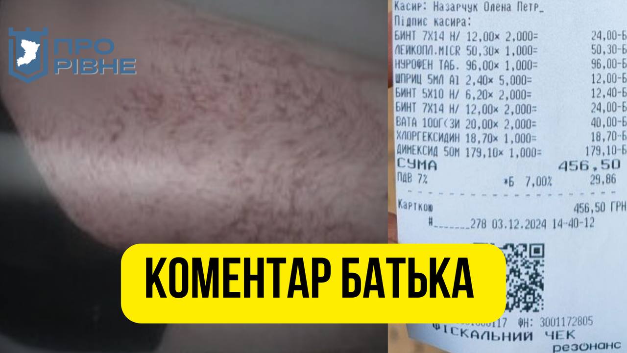 Батько учня, який поранив свого однокласника у рівненській школі, прокоментував інцидент 0000
