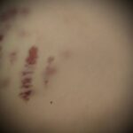 1 В лікарні на Рівненщині помер військовий: жінка звинувачує охорону закладу