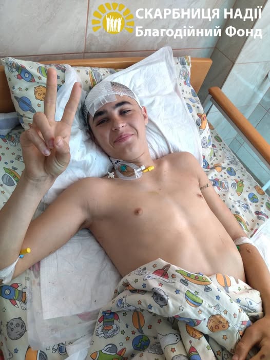 Підліток з Рівненщини потребує коштів на лікування після ДТП