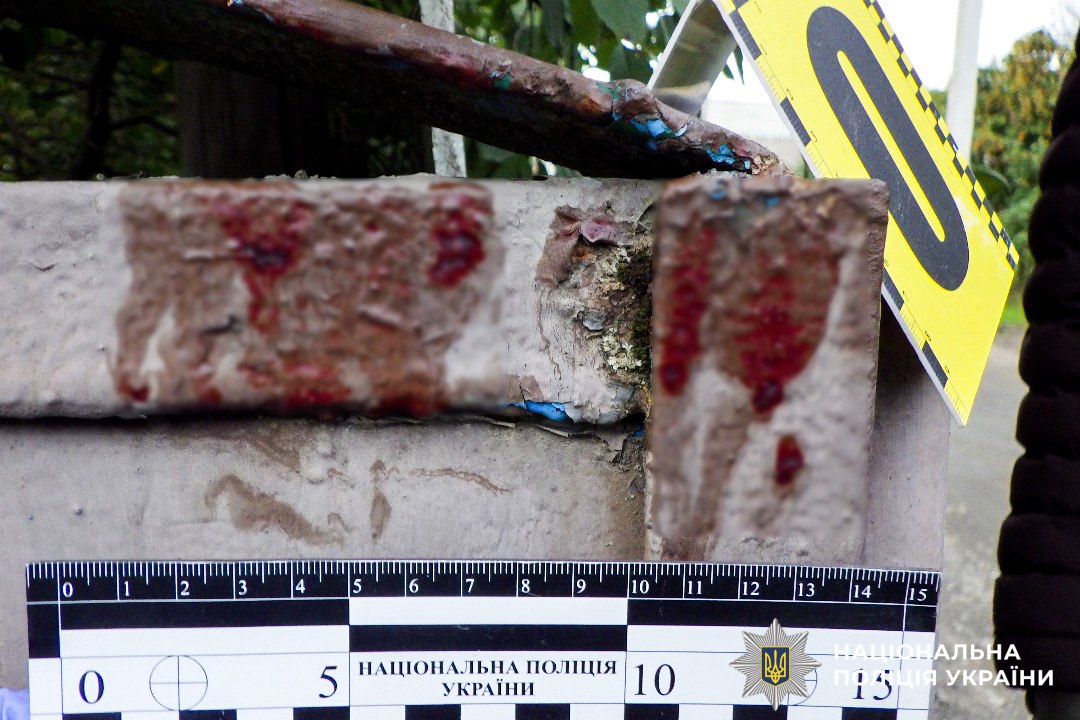 На Рівненщині чоловік завдав знайомому близько 15 ударів ножем: нападника затримали