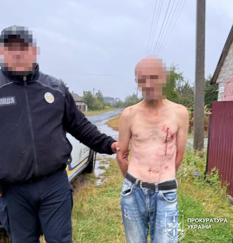 Вбив незрячого батька, завдавши 10 ударів ножем: жителя Рівненщини запроторили до психлікарні