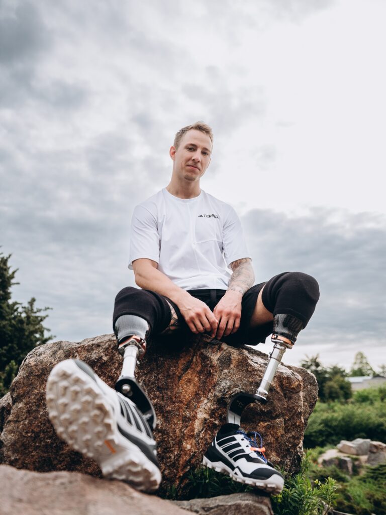 1 Герой «Холостяка» з протезами отримав державну нагороду від Зеленського: хто і за що