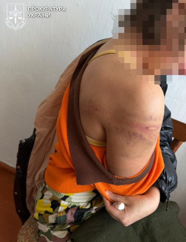 У Рівному судитимуть батька за побиття 16-річної доньки гумовим шлангом