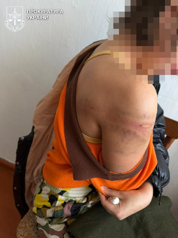 У Рівному судитимуть батька за побиття 16-річної доньки гумовим шлангом 0000