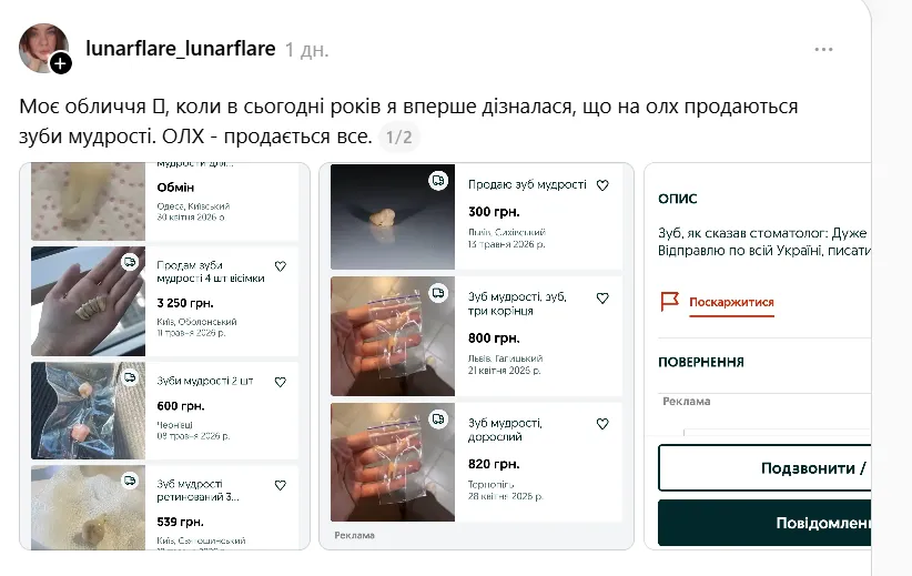 1 Бізнес на «вісімках» — чому українці масово продають свої зуби мудрості в інтернеті