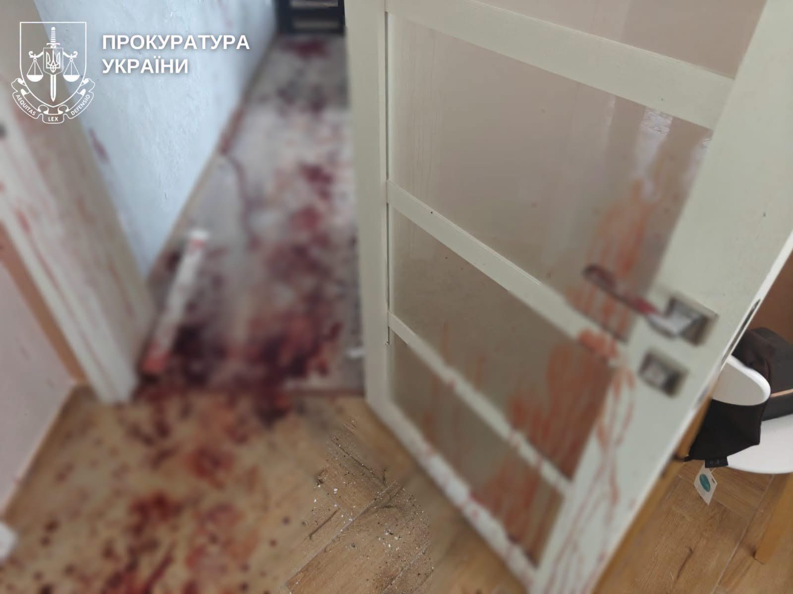 На Рівненщині граната вибухнула в руках 22-річного хлопця: він та його дівчина у тяжкому стані 0000